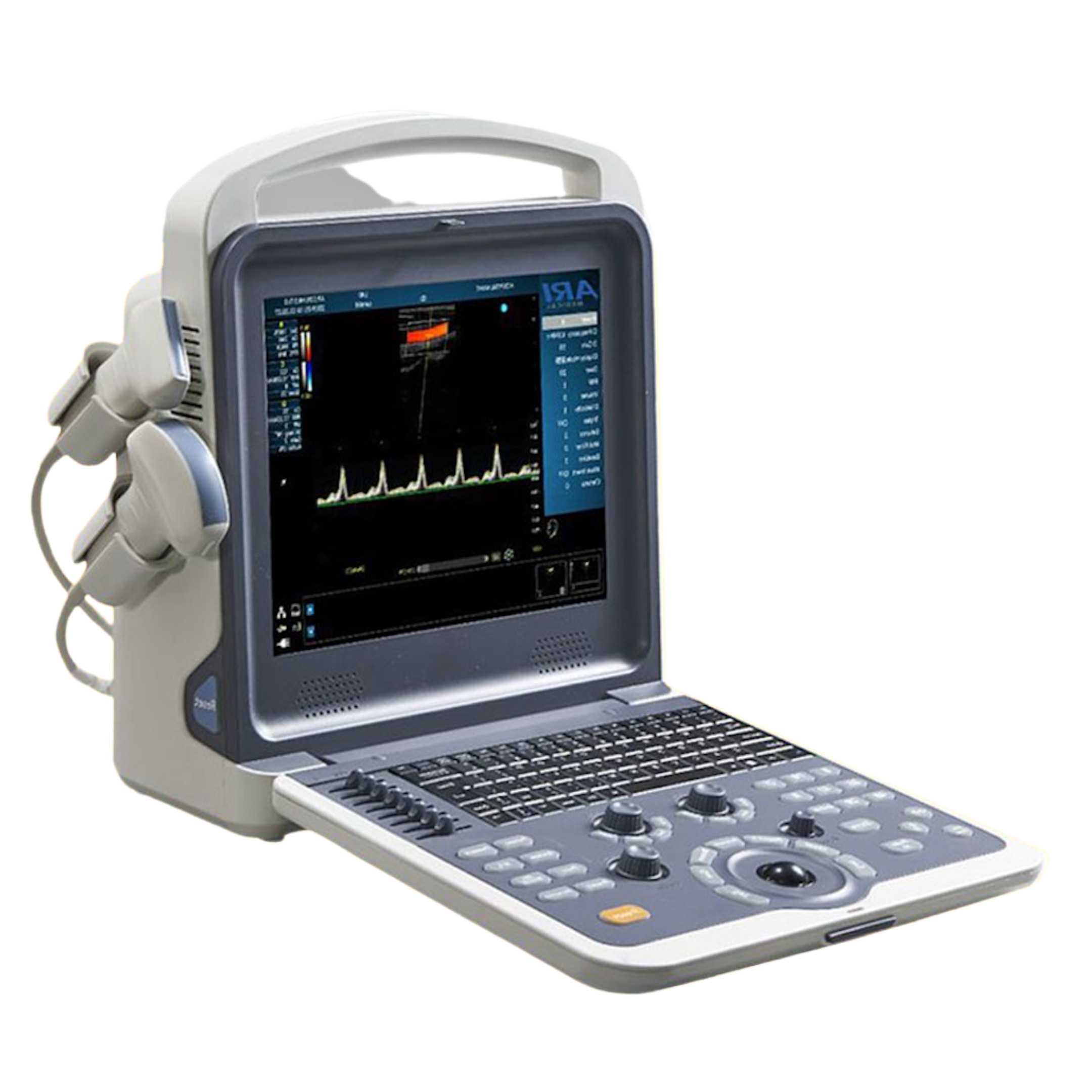 2D Echo Color Doppler